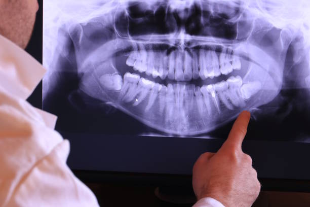 Best Emergency Treatment for Toothache in Wolfe City, TX