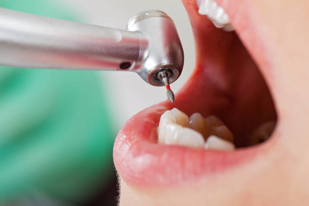 Best Emergency Orthodontic Repairs in Wolfe City, TX